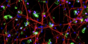 Zellkulturmodelle für die Alzheimer-Erkrankung