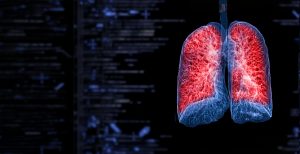 Pulmonary fibrosis
