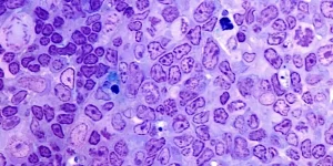 Zellkulturmodelle für Keimzentren des Immunsystems